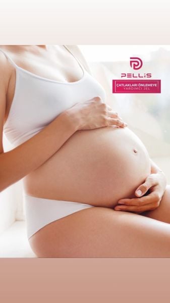 Pellis Çatlakları Önlemeye Yardımcı Jel 150 ML