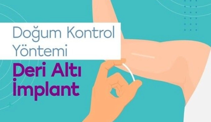 Gebelikten Korunmada Yeni Yöntemler: Deri Altı İmplant Uygulaması Nedir ve Nasıl Uygulanır?